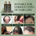Rosemary Hair Growth Shampoo with Hydrolyzed Keratin 114gm Each (Pack of 2)