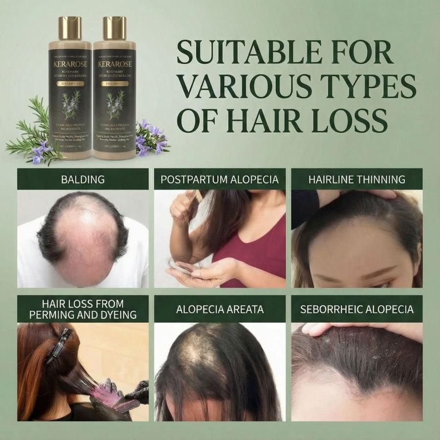 Rosemary Hair Growth Shampoo with Hydrolyzed Keratin 114gm Each (Pack of 2)